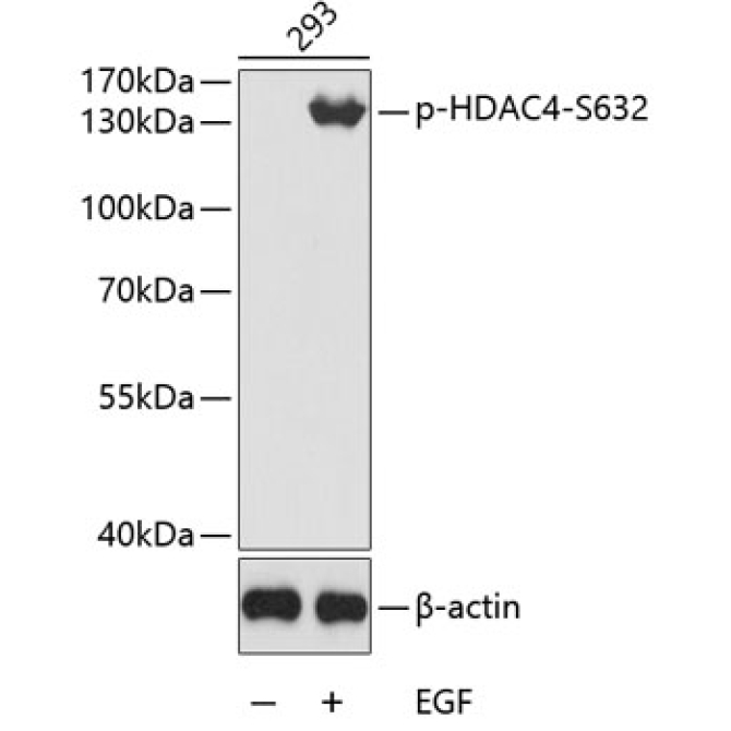 Phospho-HDAC4-S632 Rabbit Polyclonal Antibody