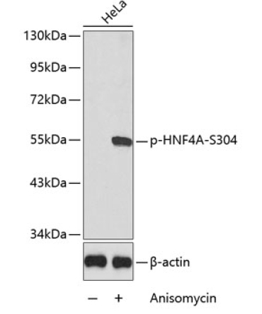 Phospho-HNF4A-S304 Rabbit Polyclonal Antibody