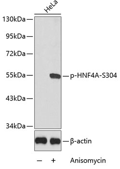 Phospho-HNF4A-S304 Rabbit Polyclonal Antibody