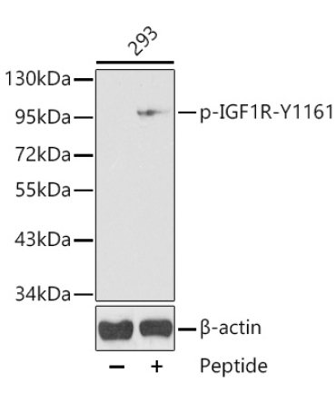 Phospho-IGF1R-Y1161 Rabbit Polyclonal Antibody