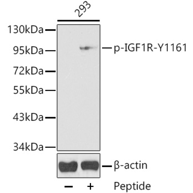 Phospho-IGF1R-Y1161 Rabbit Polyclonal Antibody