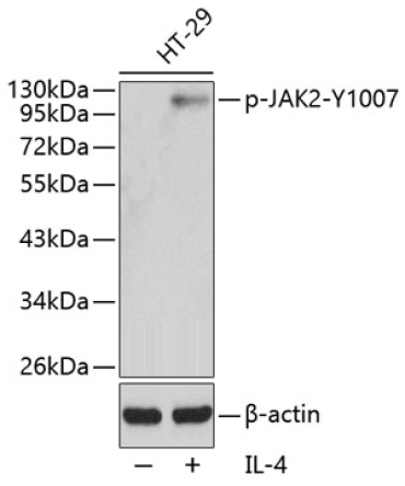 Phospho-JAK2-Y1007 Rabbit Polyclonal Antibody