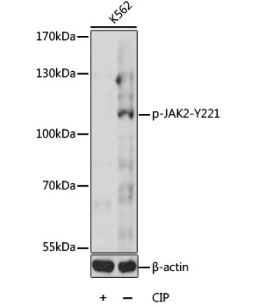 Phospho-JAK2-Y221 Rabbit Polyclonal Antibody