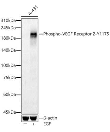 Phospho-VEGF Receptor 2-Y1175 Rabbit Polyclonal Antibody