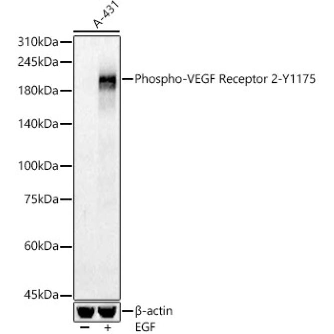 Phospho-VEGF Receptor 2-Y1175 Rabbit Polyclonal Antibody