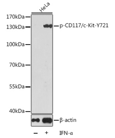 Phospho-CD117/c-Kit-Y721 Rabbit Polyclonal Antibody