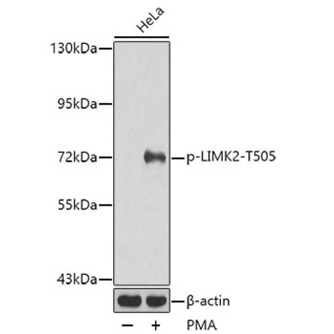 Phospho-LIMK2-T505 Rabbit Polyclonal Antibody