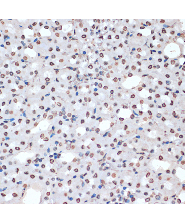 Phospho-MAPKAPK-2/MK2-T334 Rabbit Polyclonal Antibody