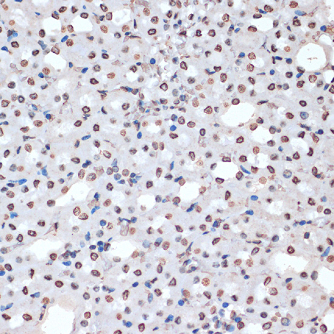 Phospho-MAPKAPK-2/MK2-T334 Rabbit Polyclonal Antibody