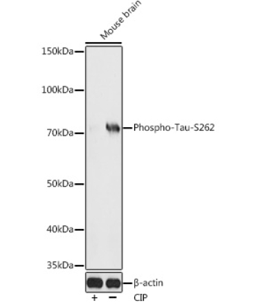 Phospho-Tau-S262 Rabbit Polyclonal Antibody