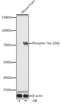 Phospho-Tau-S262 Rabbit Polyclonal Antibody