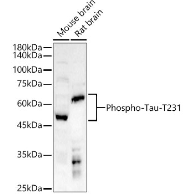 Phospho-Tau-T231 Rabbit Polyclonal Antibody