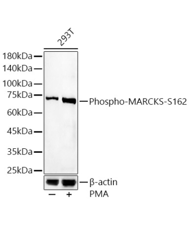 Phospho-MARCKS-S162 Rabbit Polyclonal Antibody