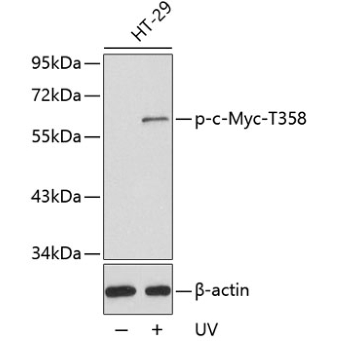 Phospho-c-Myc-T358 Rabbit Polyclonal Antibody
