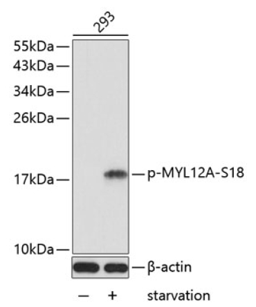 Phospho-MYL12A-S18 Rabbit Polyclonal Antibody