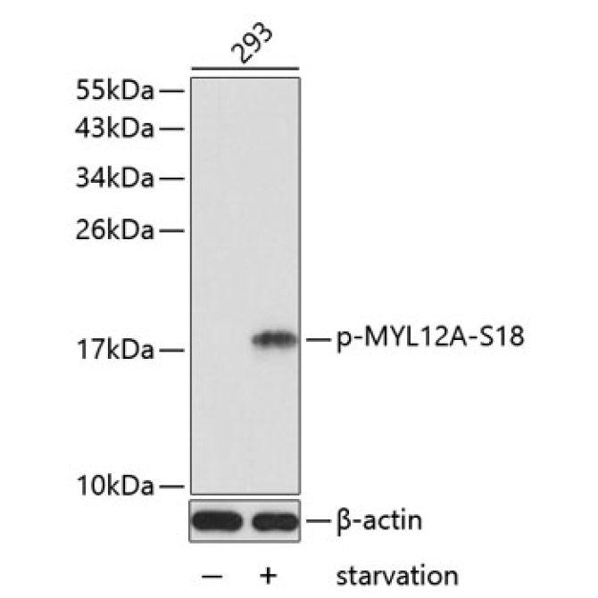 Phospho-MYL12A-S18 Rabbit Polyclonal Antibody