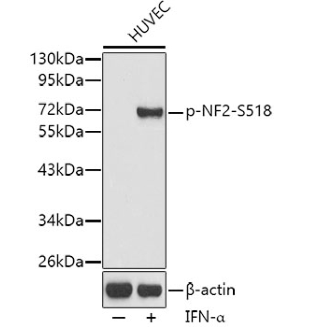 Phospho-NF2-S518 Rabbit Polyclonal Antibody