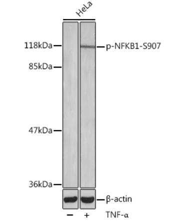 Phospho-NFKB1-S907 Rabbit Polyclonal Antibody