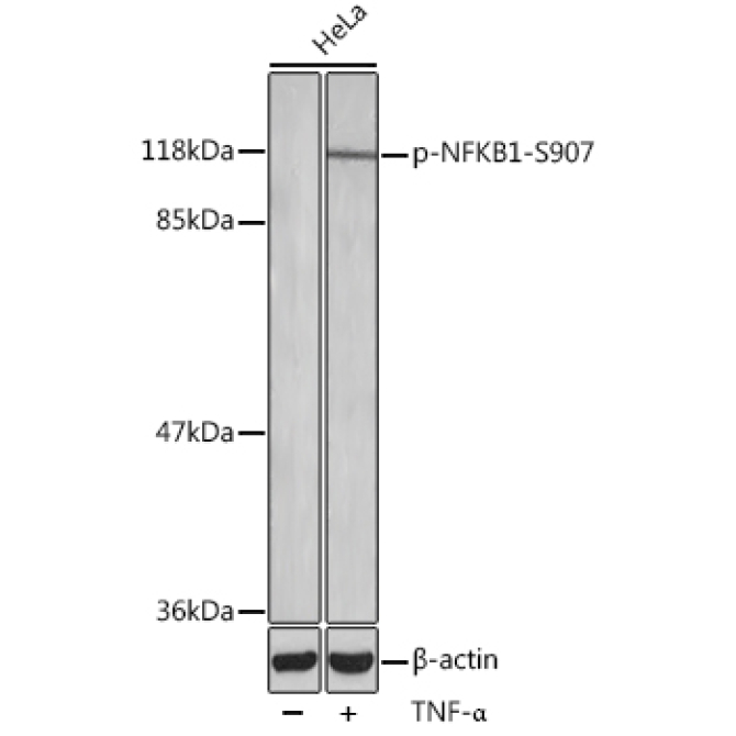 Phospho-NFKB1-S907 Rabbit Polyclonal Antibody