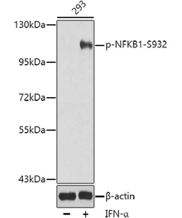 Phospho-NFKB1-S932 Rabbit Polyclonal Antibody
