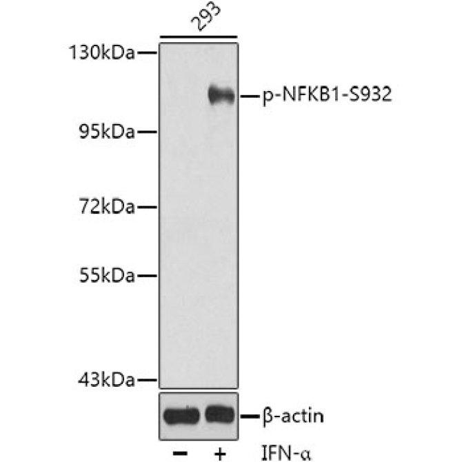Phospho-NFKB1-S932 Rabbit Polyclonal Antibody
