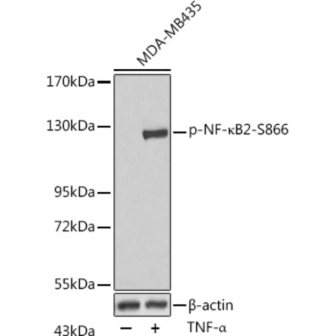 Phospho-NF-?B2-S866 Rabbit Polyclonal Antibody