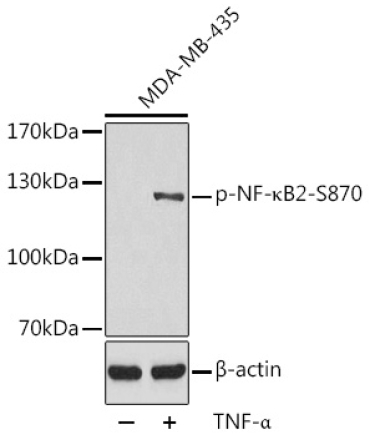 Phospho-NF-?B2-S870 Rabbit Polyclonal Antibody