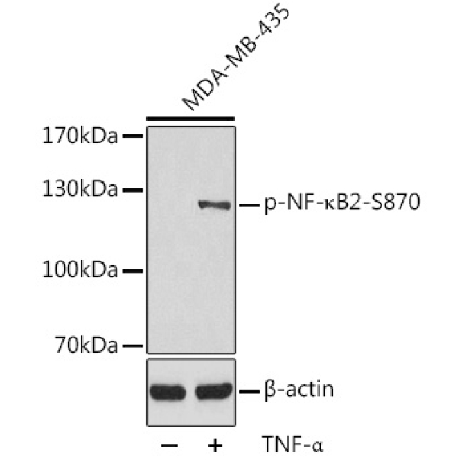 Phospho-NF-?B2-S870 Rabbit Polyclonal Antibody