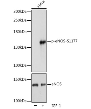 Phospho-eNOS-S1177 Rabbit Polyclonal Antibody