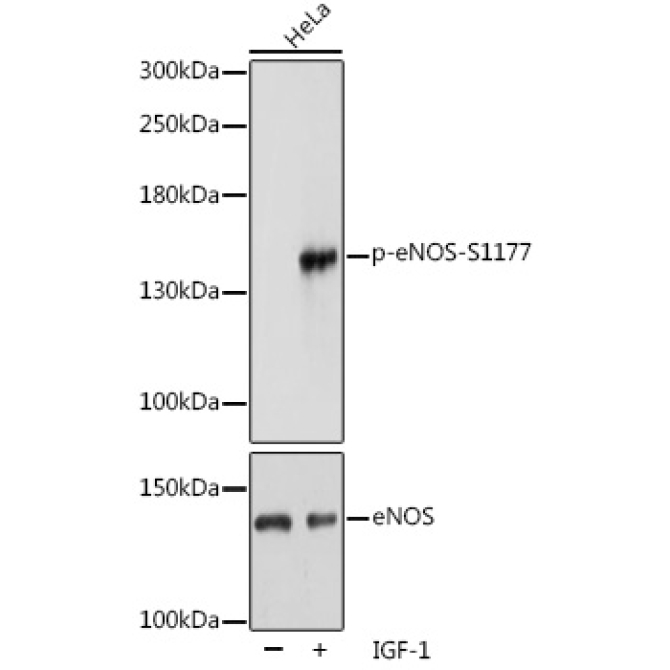 Phospho-eNOS-S1177 Rabbit Polyclonal Antibody