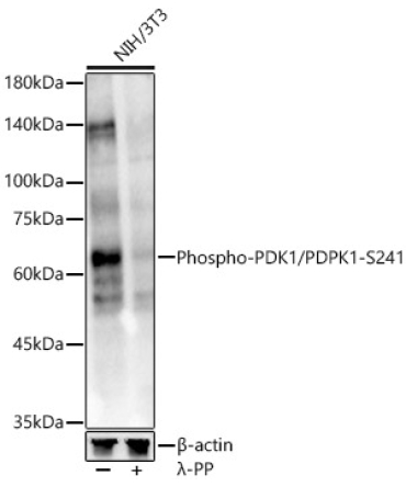 Phospho-PDK1/PDPK1-S241 Rabbit Polyclonal Antibody