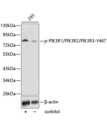 Phospho-PI3KP85Alpha/P55Gamma/P85Beta-Y467/Y464/Y199 Rabbit Polyclonal Antibody