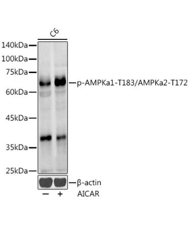 Phospho-AMPKa1-T183/AMPKa2-T172 Rabbit Polyclonal Antibody