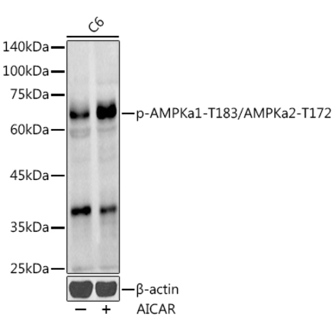 Phospho-AMPKa1-T183/AMPKa2-T172 Rabbit Polyclonal Antibody