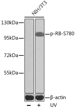Phospho-RB-S780 Rabbit Polyclonal Antibody