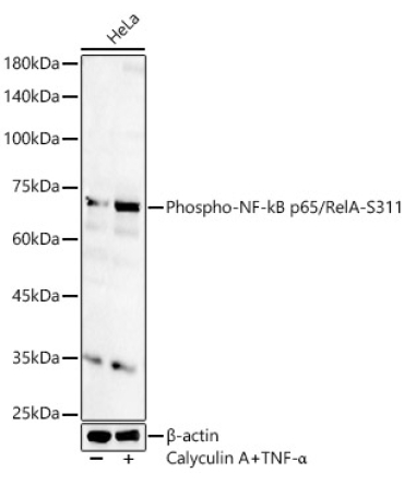 Phospho-NF-kB p65/RelA-S311 Rabbit Polyclonal Antibody
