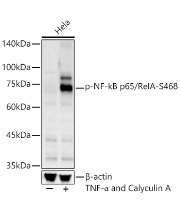Phospho-NF-kB p65/RelA-S468 Rabbit Polyclonal Antibody