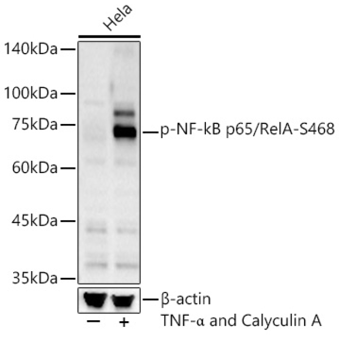 Phospho-NF-kB p65/RelA-S468 Rabbit Polyclonal Antibody