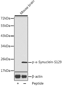 Phospho-Alpha-Synuclein-S129 Rabbit Polyclonal Antibody
