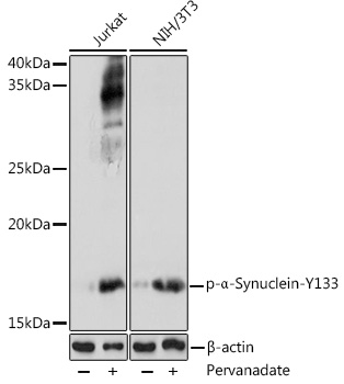 Phospho-Alpha-Synuclein-Y133 Rabbit Polyclonal Antibody