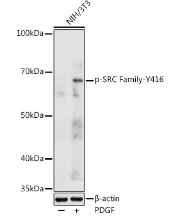 Phospho-SRC Family-Y416 Rabbit Polyclonal Antibody