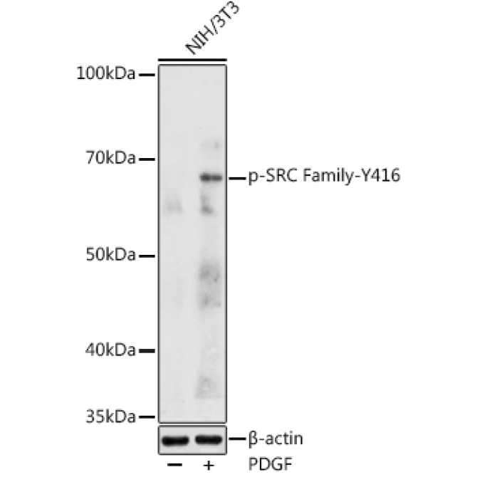 Phospho-SRC Family-Y416 Rabbit Polyclonal Antibody