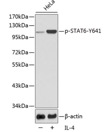 Phospho-STAT6-Y641 Rabbit Polyclonal Antibody