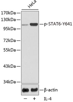 Phospho-STAT6-Y641 Rabbit Polyclonal Antibody