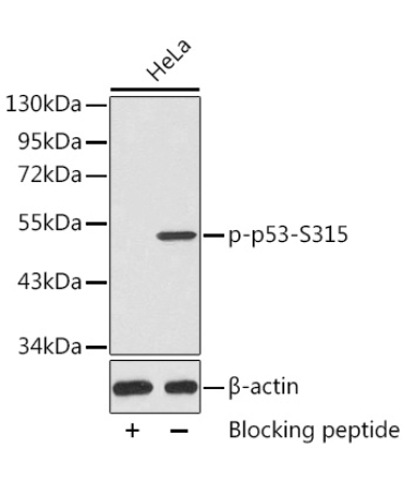 Phospho-p53-S315 Rabbit Polyclonal Antibody