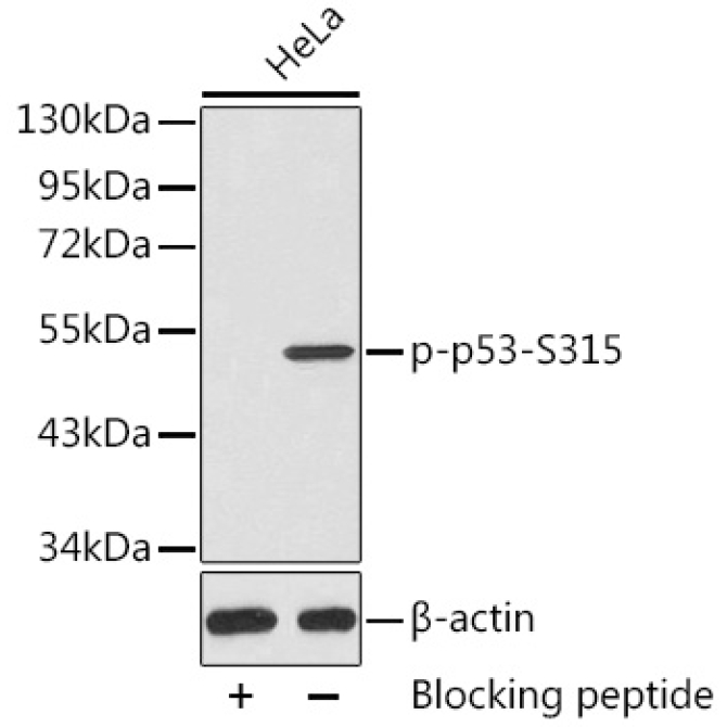 Phospho-p53-S315 Rabbit Polyclonal Antibody