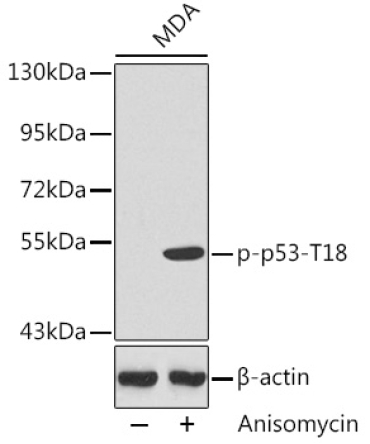 Phospho-p53-T18 Rabbit Polyclonal Antibody