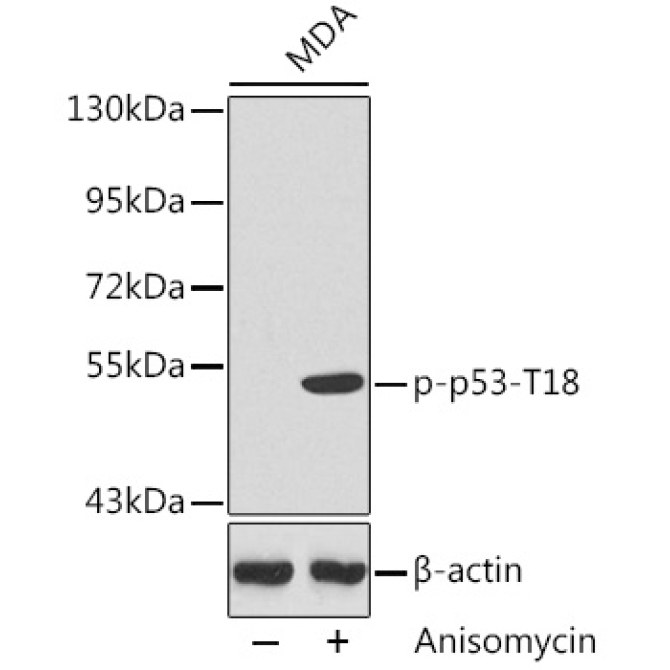 Phospho-p53-T18 Rabbit Polyclonal Antibody
