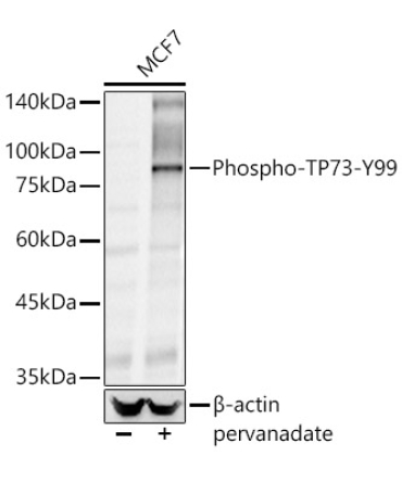 Phospho-TP73-Y99 Rabbit Polyclonal Antibody
