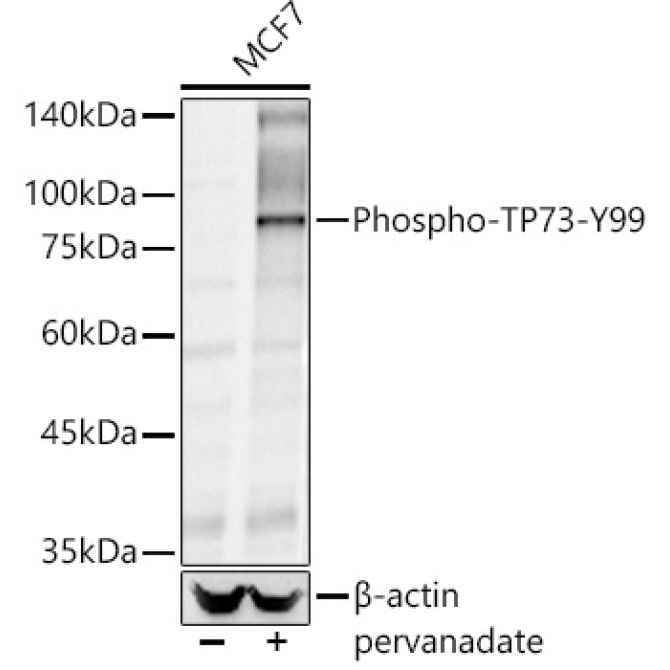 Phospho-TP73-Y99 Rabbit Polyclonal Antibody